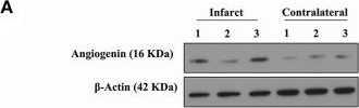 Fig.6.A showing Western Blotting in a Homo sapiens (Human) sample from the publication: Importance of Angiogenin and Endothelial Progenitor Cells After Rehabilitation Both in Ischemic Stroke Patients and in a Mouse Model of Cerebral Ischemia.