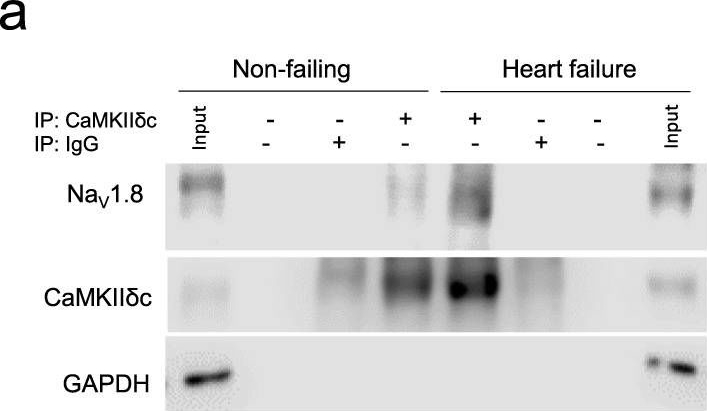 Fig.1.A showing Western Blotting in a Homo sapiens (Human) sample from the publication: Detrimental proarrhythmogenic interaction of Ca2+/calmodulin-dependent protein kinase II and NaV1.8 in heart failure.