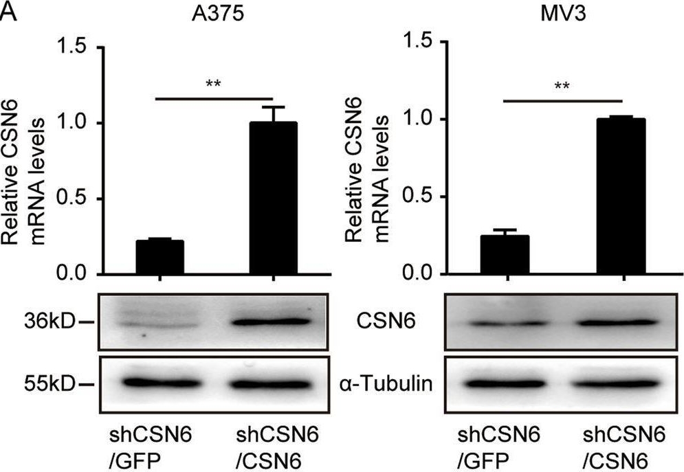 Fig.3.A showing Western Blotting in a Homo sapiens (Human) sample from the publication: CSN6 promotes melanoma proliferation and metastasis by controlling the UBR5-mediated ubiquitination and degradation of CDK9.