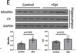 Fig.4.E showing Western Blotting from the publication: Stimulatory Effects of (+)-Epicatechin on Short- and Long-Term Memory in Aged Rats: Underlying Mechanisms.