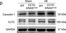 Fig.5.P showing Western Blotting from the publication: Tumor Extracellular Vesicles Aggravate Mitochondrial Damage in Myocardial Ischemia/Reperfusion Injury.