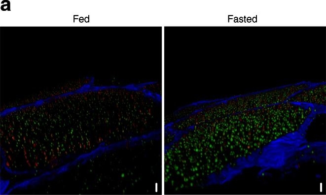 Decoration of intramyocellular lipid droplets with PLIN5 modulates fasting-induced insulin resistance and lipotoxicity in humans.