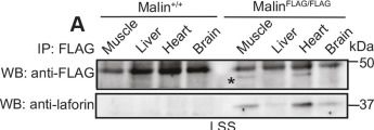 Fig.3.A showing Western Blotting from the publication: Laforin targets malin to glycogen in Lafora progressive myoclonus epilepsy.