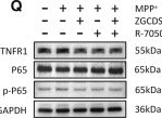 Fig.8.Q showing Western Blotting from the publication: Zhigancao decoction alleviates Parkinson's disease via inhibiting TNF/NF-κB and Ras/ERK-mediated neuroinflammation and apoptosis.