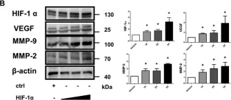 Fig.1.B showing Western Blotting from the publication: Inhibition of hypoxia inducible factor-1α attenuates abdominal aortic aneurysm progression through the down-regulation of matrix metalloproteinases.