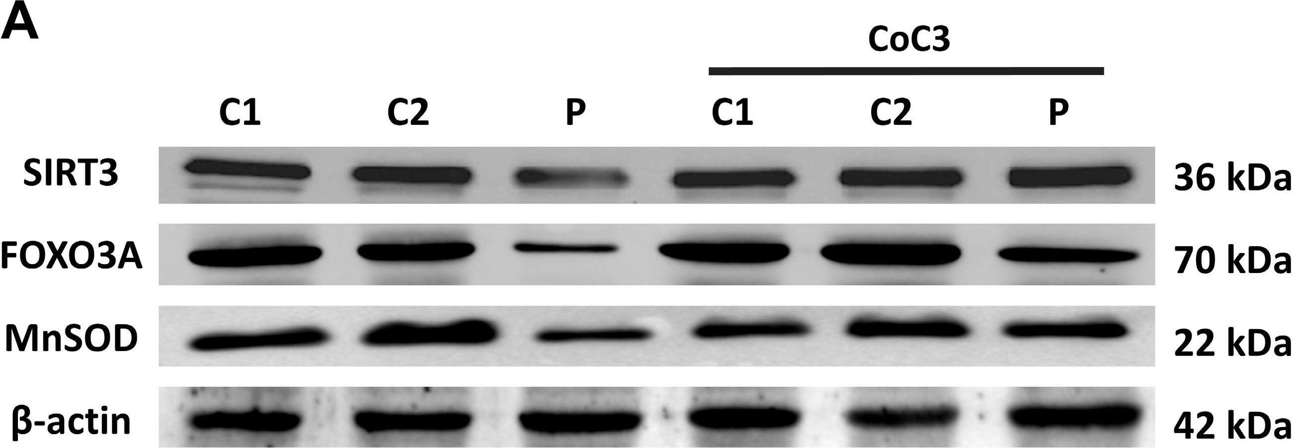 Fig.16.A showing Western Blotting from the publication: Mitochondrial Unfolded Protein Response (mtUPR) Activation Improves Pathological Alterations in Cellular Models of Ethylmalonic Encephalopathy.