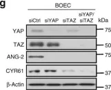 Fig.5.G showing Western Blotting from the publication: A LATS biosensor screen identifies VEGFR as a regulator of the Hippo pathway in angiogenesis.