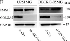 Fig.3.E showing Western Blotting from the publication: Formin-like 1 (FMNL1) Is Associated with Glioblastoma Multiforme Mesenchymal Subtype and Independently Predicts Poor Prognosis.