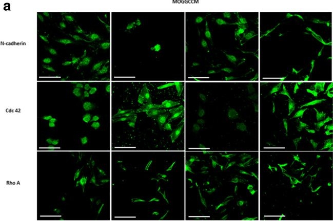 Fig.5.A showing Immunocytochemistry-immunofluorescence from the publication: Proapoptotic and antimigration properties of osthole in combination with LY294002 against human glioma cells.
