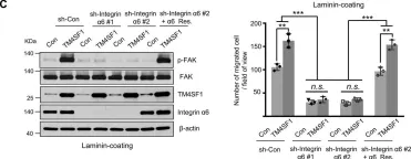 Fig.5.C showing Western Blotting from the publication: TM4SF1 promotes esophageal squamous cell carcinoma metastasis by interacting with integrin α6.