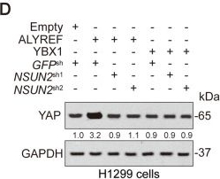 Fig.2.D showing Western Blotting in a Homo sapiens (Human) sample from the publication: YAP 5-methylcytosine modification increases its mRNA stability and promotes the transcription of exosome secretion-related genes in lung adenocarcinoma.