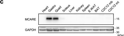Fig.1.C showing Western Blotting from the publication: MCARE enhances SERCA1 activity in fast-twitch muscle to maintain calcium handling and muscle integrity.