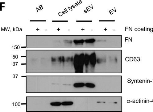 Fig.1.F showing Western Blotting from the publication: Matrix-associated extracellular vesicles modulate human smooth muscle cell adhesion and directionality by presenting collagen VI.