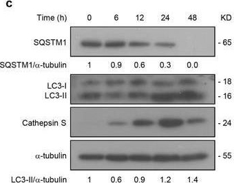Fig.1.C showing Western Blotting in a Homo sapiens (Human) sample from the publication: Exophagy of annexin A2 via RAB11, RAB8A and RAB27A in IFN-γ-stimulated lung epithelial cells.