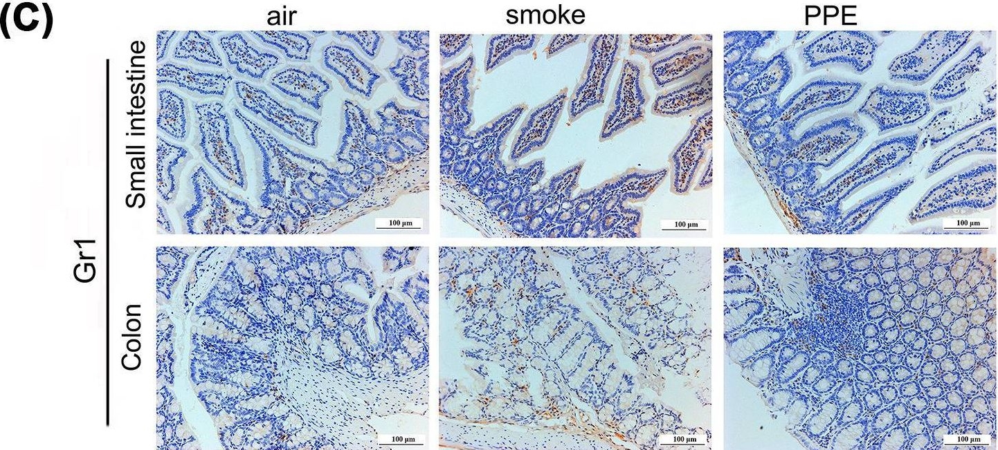 Fig.5.C showing Immunohistochemistry from the publication: Gr1+ myeloid-derived suppressor cells participate in the regulation of lung-gut axis during mouse emphysema model.