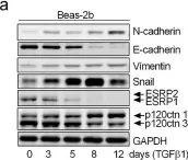 Fig.4.A showing Western Blotting from the publication: Up-regulated miR-133a orchestrates epithelial-mesenchymal transition of airway epithelial cells.