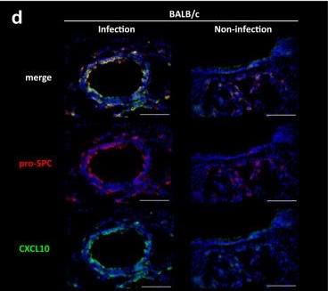 Fig.7.D showing Immunohistochemistry-immunofluorescence in a Mus musculus (House mouse) sample from the publication: Amino acid catabolite markers for early prognostication of pneumonia in patients with COVID-19.