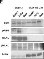 Fig.2.E showing Western Blotting from the publication: Gasdermin D Cleavage and Cytokine Release, Indicative of Pyroptotic Cell Death, Induced by Ophiobolin A in Breast Cancer Cell Lines.