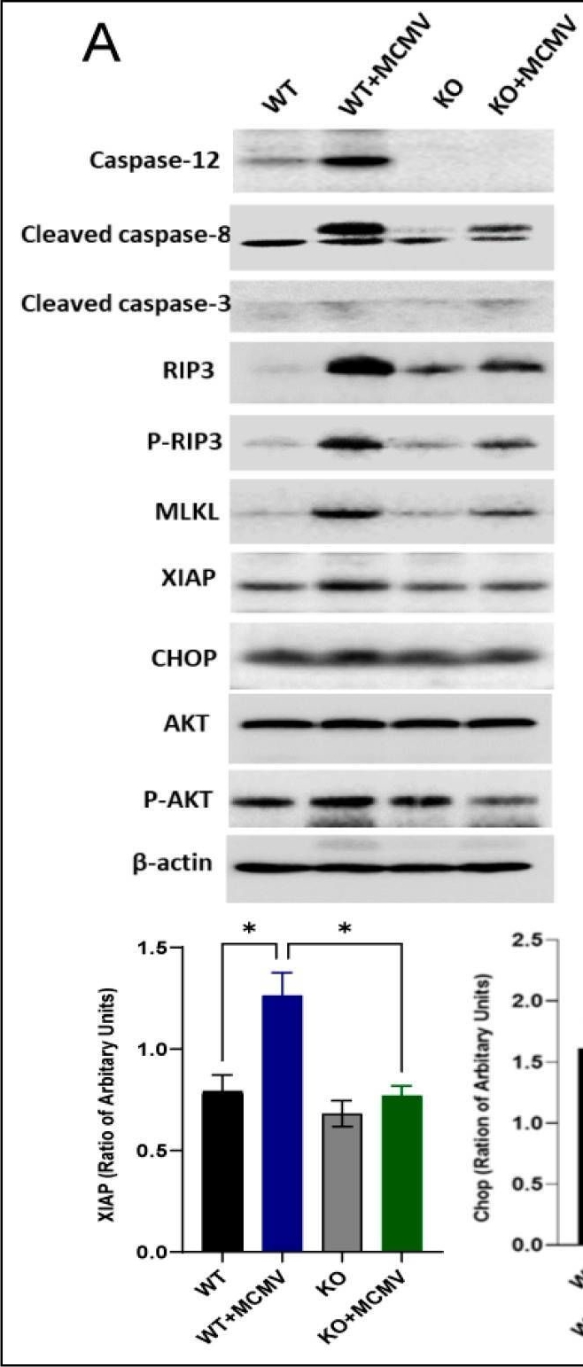 Fig.3.A showing Western Blotting in a Mus musculus (House mouse) sample from the publication: Depletion of Caspase-12 Alleviates Retinal Degeneration in Aged BALB/c Mice Following Systemic Neonatal Infection by Murine Cytomegalovirus (MCMV).