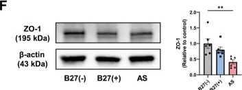 Fig.6.F showing Western Blotting in a Homo sapiens (Human) sample from the publication: HLA-B27-associated gut microbiota and amino acid perturbations promote ankylosing spondylitis through M1 macrophage activation.