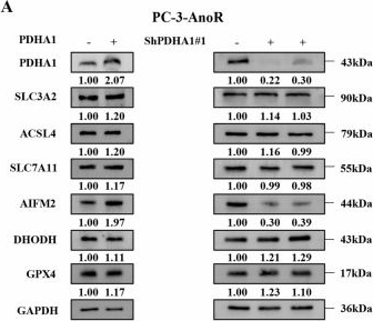 Fig.3.A showing Western Blotting from the publication: PDHA1 enhances resistance to ferroptosis in anoikis-resistant prostate cancer by upregulating AIFM2.