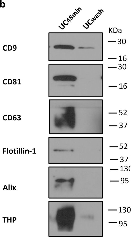 Fig.4.B showing Western Blotting in a Homo sapiens (Human) sample from the publication: Improved recovery of urinary small extracellular vesicles by differential ultracentrifugation.