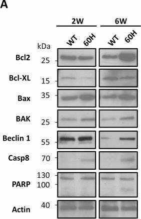 Fig.6.A showing Western Blotting from the publication: Aberrant mitochondrial hsp60 expression affects mitochondria homeostasis and results in muscle dystrophy and premature death.