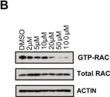 Fig.2.B showing Western Blotting from the publication: Validation of a small molecule inhibitor of PDE6D-RAS interaction with favorable anti-leukemic effects.