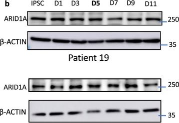 Fig.7.B showing Western Blotting in a Mus musculus (House mouse) sample from the publication: Inability to switch from ARID1A-BAF to ARID1B-BAF impairs exit from pluripotency and commitment towards neural crest formation in ARID1B-related neurodevelopmental disorders.