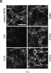 Fig.3.C showing Immunocytochemistry-immunofluorescence from the publication: Personalized Vascularized Models of Breast Cancer Desmoplasia Reveal Biomechanical Determinants of Drug Delivery to the Tumor.