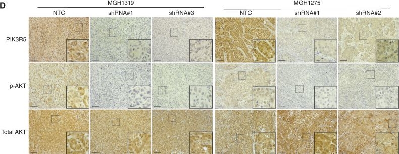 Fig.6.D showing Immunohistochemistry from the publication: Collagen XVII Promotes Pancreatic Ductal Adenocarcinoma Tumor Growth through Regulation of PIK3R5.