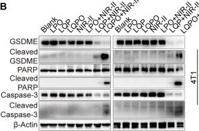 Fig.4.B showing Western Blotting from the publication: Multimodal imaging-guided NIR-II photo-gas nanoplatform amplifies PD-1 blockade for synergistic TNBC therapy.