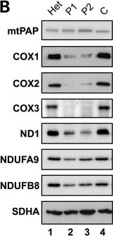 Fig.1.B showing Western Blotting in a Homo sapiens (Human) sample from the publication: A human mitochondrial poly(A) polymerase mutation reveals the complexities of post-transcriptional mitochondrial gene expression.