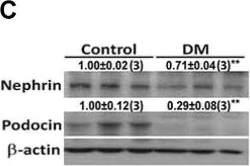 Albumin stimulates renal tubular inflammation through an HSP70-TLR4 axis in mice with early diabetic nephropathy.