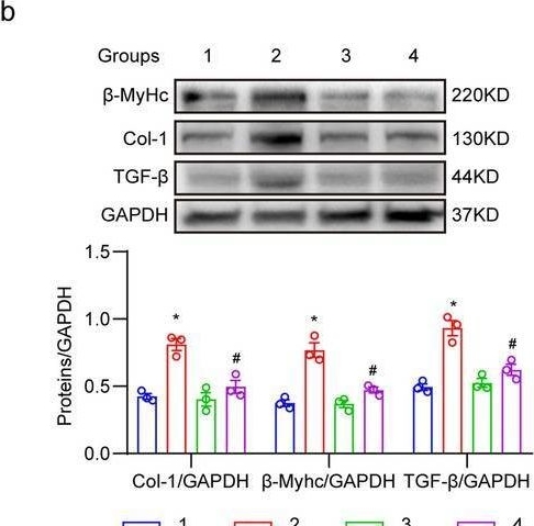 Fig.6.B showing Western Blotting in a Mus musculus (House mouse) sample from the publication: Myeloid MyD88 Mediates Macrophage Infiltration and Activation in Ang II-Induced Cardiac Hypertrophy.