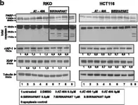 Fig.2.B showing Western Blotting in a Homo sapiens (Human) sample from the publication: IAP antagonists Birinapant and AT-406 efficiently synergise with either TRAIL, BRAF, or BCL-2 inhibitors to sensitise BRAFV600E colorectal tumour cells to apoptosis.