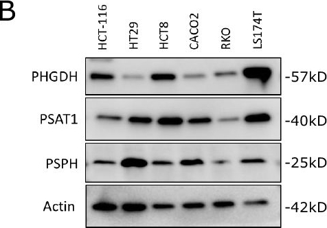 Fig.1.B showing Western Blotting in a Mus musculus (House mouse) sample from the publication: Limiting serine availability during tumor progression promotes muscle wasting in cancer cachexia.