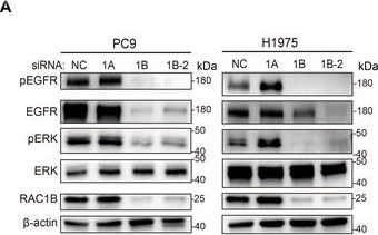 Fig.4.A showing Western Blotting in a Homo sapiens (Human) sample from the publication: Splicing Shift of RAC1 Accelerates Tumorigenesis and Defines a Potent Therapeutic Target in Lung Cancer.