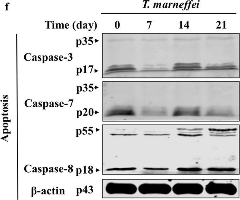 Fig.6.F showing Western Blotting in a Mus musculus (House mouse) sample from the publication: PANoptosis-mediated mechanisms underlying AST elevation in Talaromyces marneffei infection.