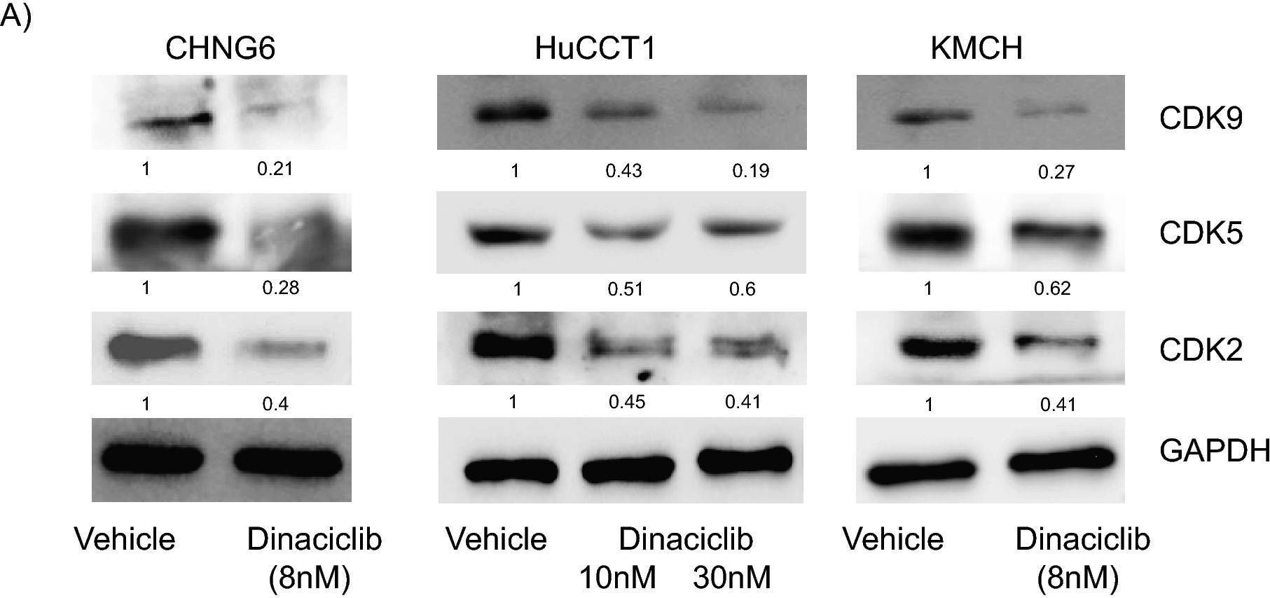 Fig.5.A showing Western Blotting from the publication: Dinaciclib, a cyclin-dependent kinase inhibitor, suppresses cholangiocarcinoma growth by targeting CDK2/5/9.