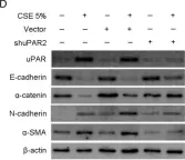 Fig.5.D showing Western Blotting in a Homo sapiens (Human) sample from the publication: The role of uPAR in epithelial-mesenchymal transition in small airway epithelium of patients with chronic obstructive pulmonary disease.
