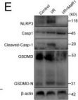 専用ページ Cleaved Caspase-1 (Asp296) (E2G2I) Rabbit Monoclonal Antibody