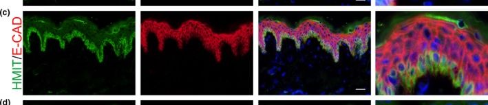 Fig.1.C showing Immunohistochemistry-immunofluorescence from the publication: Osmolyte transporter expression is reduced in photoaged human skin: Implications for skin hydration in aging.