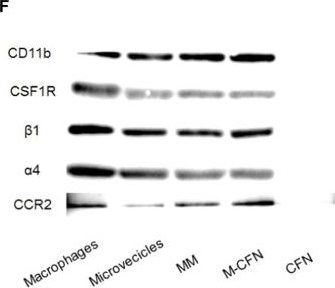 Fig.1.F showing Western Blotting from the publication: M2 macrophage microvesicle-inspired nanovehicles improve accessibility to cancer cells and cancer stem cells in tumors.