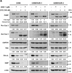 Fig.5.A showing Western Blotting in a Homo sapiens (Human) sample from the publication: HDAC6-Selective Inhibitor Overcomes Bortezomib Resistance in Multiple Myeloma.