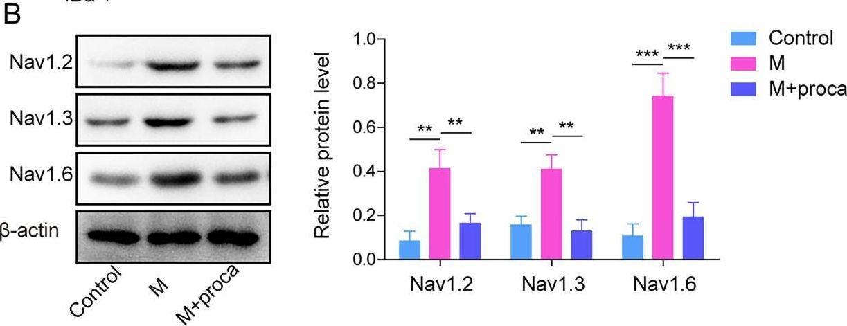 Fig.4.B showing Western Blotting in a Mus musculus (House mouse) sample from the publication: Procaine Regulates the STAT3/CCL5 Axis and Inhibits Microglia M1 Polarization to Alleviate Complete Freund's Adjuvant Rats Pain Behavior.