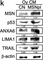 Fig.6.K showing Western Blotting from the publication: Induced Tumor-Suppressing (iTS) Cell-Based Approach for Protecting the Bone from Advanced Prostate Cancer.