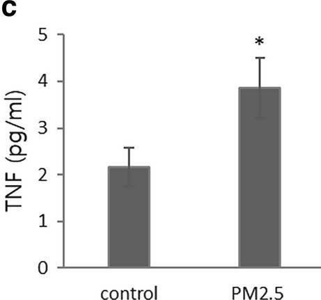 Fig.5.C showing Enzyme-linked immunosorbent assay from the publication: Integrative analysis to explore the biological association between environmental skin diseases and ambient particulate matter.