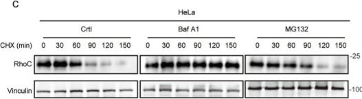 Fig.3.C showing Western Blotting in a Homo sapiens (Human) sample from the publication: RAB33A promotes metastasis via RhoC accumulation through non-canonical autophagy in cervical cancer.