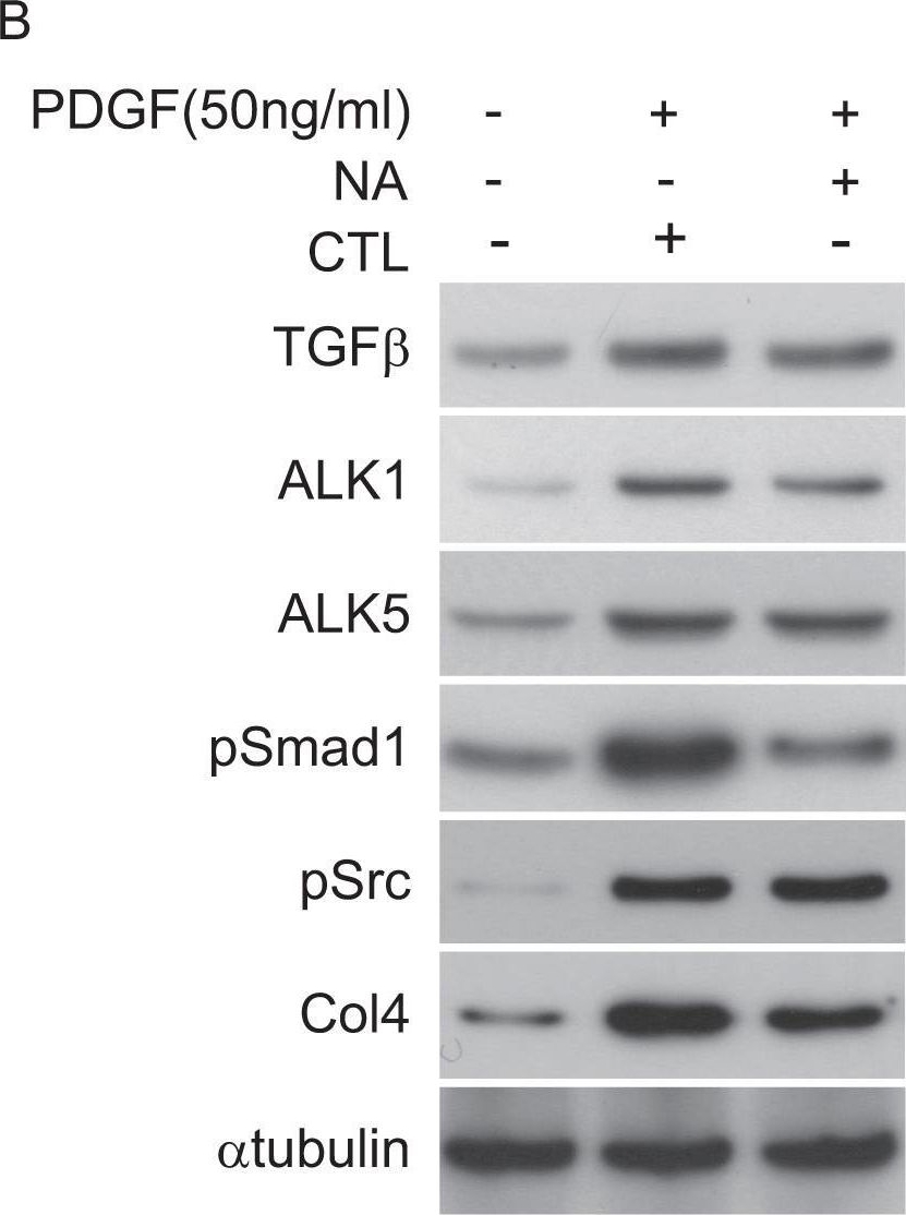 Activation of Src mediates PDGF-induced Smad1 phosphorylation and contributes to the progression of glomerulosclerosis in glomerulonephritis.